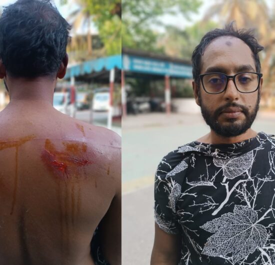 বরিশালে সাবেক ছাত্রদল সভাপতি ও যুগ্ন আহবায়ক এর উপর হামলা