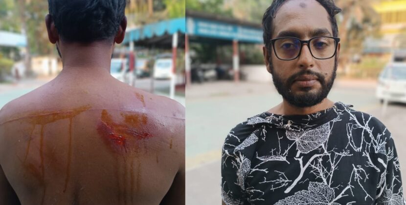 বরিশালে সাবেক ছাত্রদল সভাপতি ও যুগ্ন আহবায়ক এর উপর হামলা