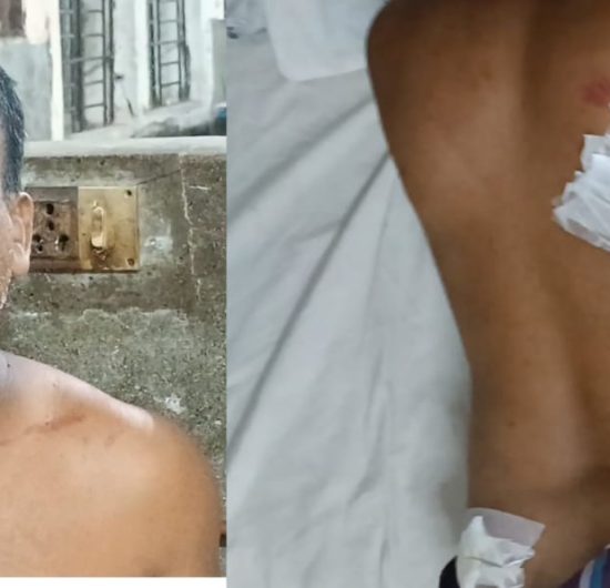 বরিশালে যুবদল নেতাকে কুপিয়ে হত্যা চেষ্টা